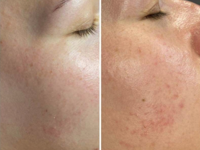 Screenshot 2025-03-05 at 2.36.37 PM